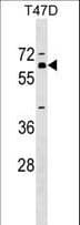 ZNF554 Antibody (aa172-198)