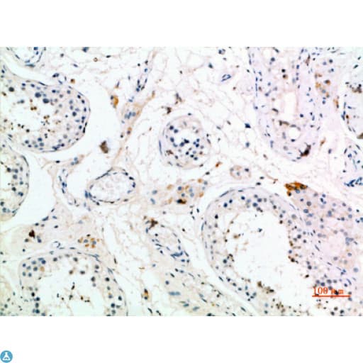 PMCH / MCH Antibody