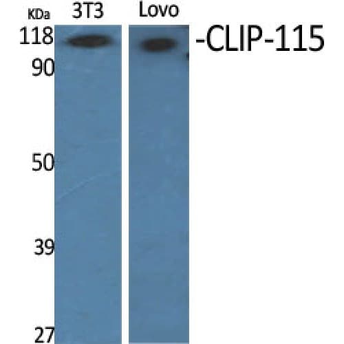 Polyclonal Rabbit anti-Human CLIP2 / CYLN2 Antibody (960-1040 aa, C-terminal, WB)