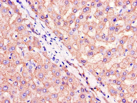 CIDEA / CIDE-A Antibody