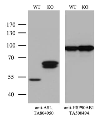 ASL / Argininosuccinate Lyase Antibody (clone OTI14C7, Carrier-free)