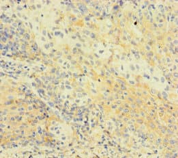 Polyclonal Rabbit anti-Human C1orf112 Antibody
