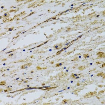PECAM-1 / CD31 Antibody