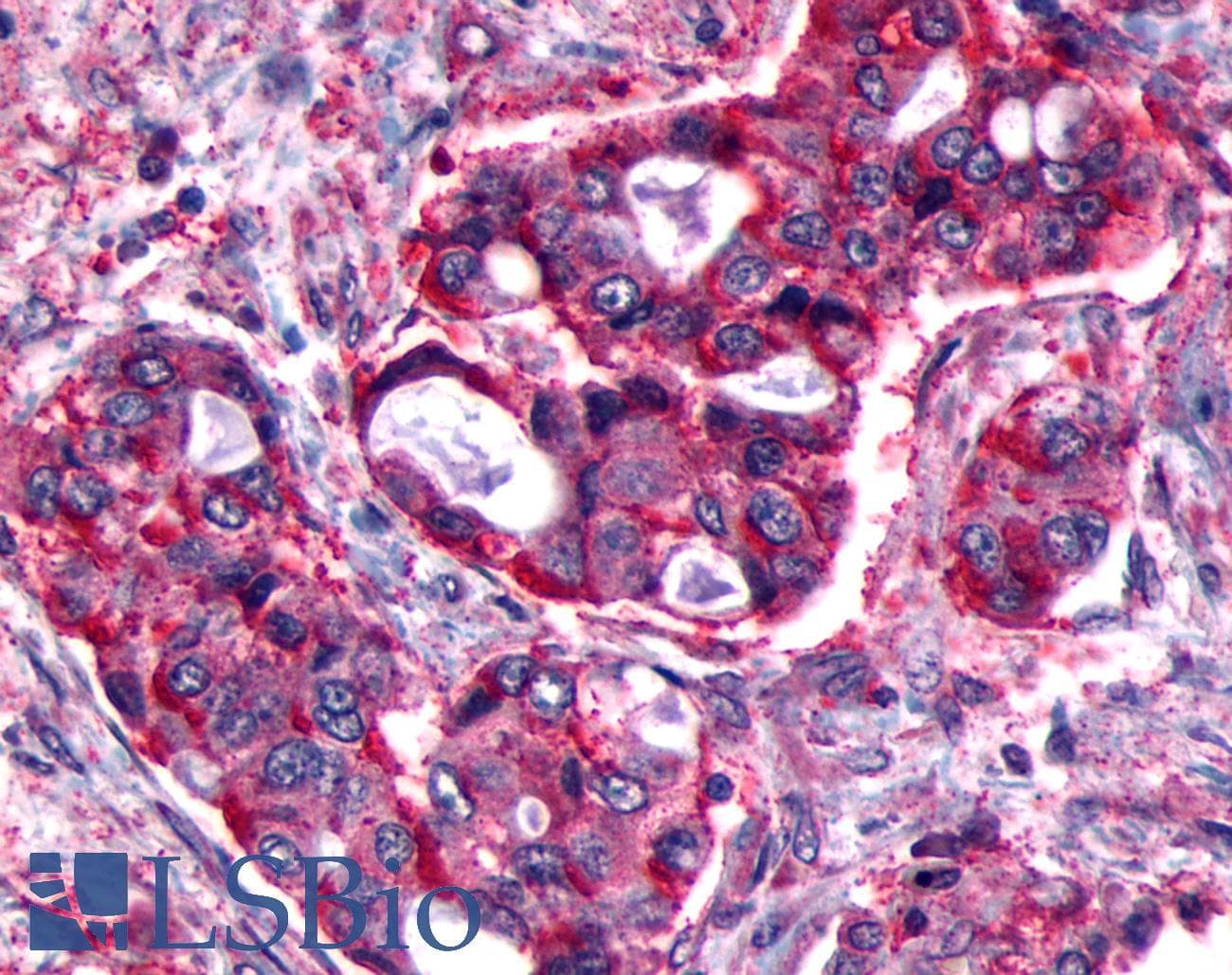 PathPlus™ FP / PTGFR Antibody (Extracellular Domain)