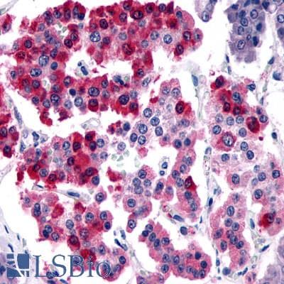 IHC-plus™ SSTR4 Antibody (N-Terminus)