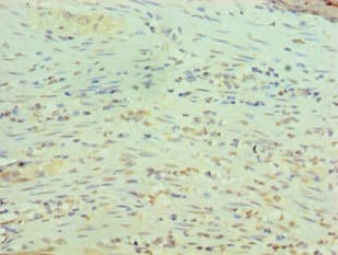 RBBP5 Antibody (aa319-538)