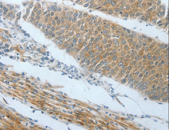 AMPH / Amphiphysin Antibody