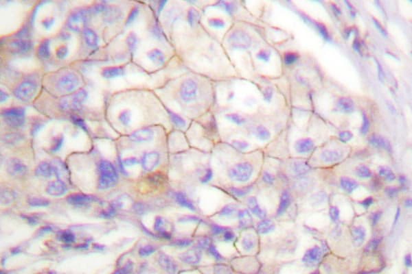 CD95 / FAS Antibody (Leu315)