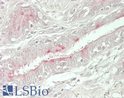 IHC-plus™ EPHX4 / Epoxide Hydrolase 4 Antibody (Internal)