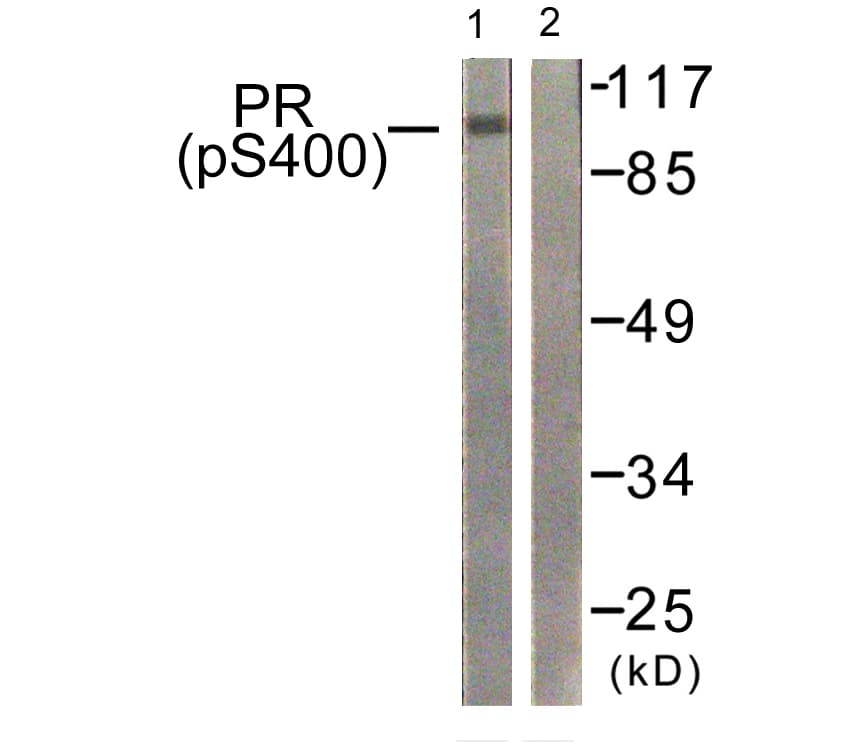 PR / Progesterone Receptor Antibody (phospho-Ser400)