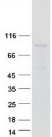 Human SYTL5 Protein (Recombinant Myc-DDK (Flag))