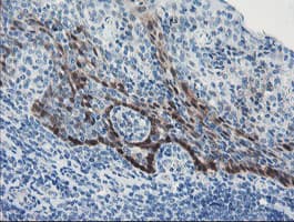 IHC-plus™ ADH7 Antibody (clone 2D11)