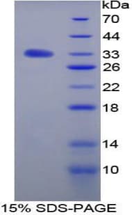 Rat Betaglycan / TGFBR3 Protein (Recombinant His-T7)