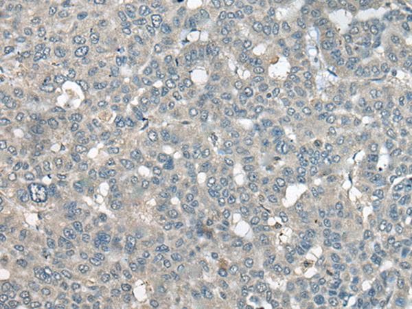 UCN3 / SPC Antibody