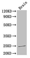 Polyclonal Rabbit anti-Human HMG1 / HMGB1 Antibody (IHC, WB)