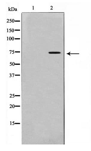 Polyclonal Rabbit anti-Human IL2RB / CD122 Antibody (IHC, WB)