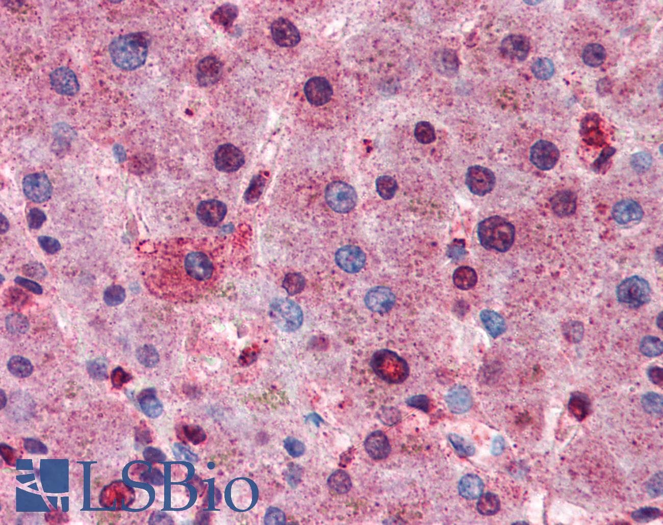 IHC-plus™ AKT1 + AKT2 + AKT3 Antibody (aa460-480)