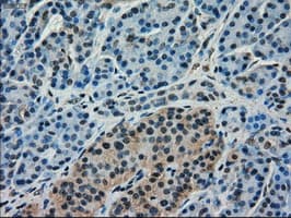 KIND2 / FERMT2 Antibody (clone 25A4, Carrier-free)