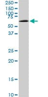 Monoclonal Mouse anti-Human MAK Antibody (clone 3E5, IF, WB)