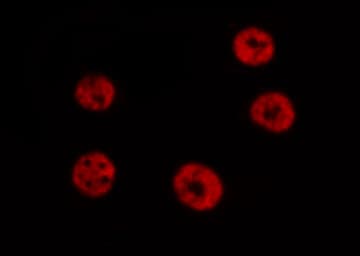 STAT6 Antibody (phospho-Thr645)