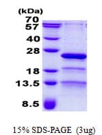 Human RP9 Protein (Recombinant His)