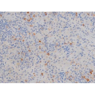MAPT / Tau Antibody (phospho-Ser214)