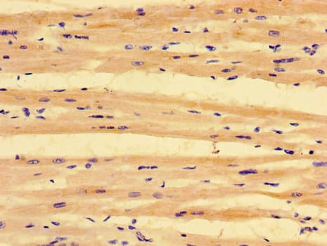 Polyclonal Rabbit anti-Human PKD1L3 Antibody (IHC, IF)