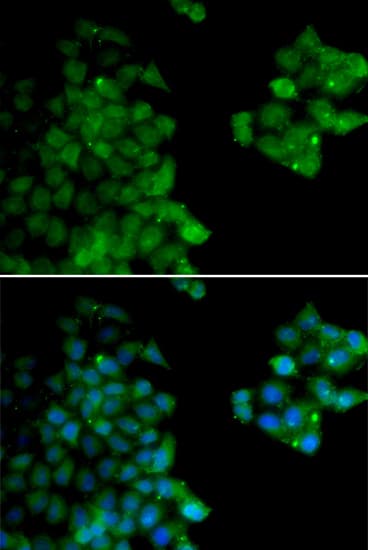 Polyclonal Rabbit anti-Human PSMB10 Antibody (IHC, IF, WB)