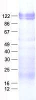 Human ZNF274 Protein (Recombinant His, N-Terminal)
