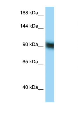 Polyclonal Rabbit anti-Human ZFP62 Antibody (C-Terminus, WB)