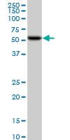 Monoclonal Mouse anti-Human CDK8 Antibody (clone 6H5, WB)