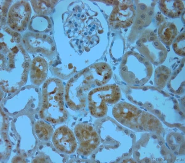 Polyclonal Rabbit anti-Human ITPR1 / IP3 Receptor Type 1 Antibody (aa700-750, IHC)
