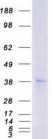 Human P2RY12 / P2Y12 Protein (Recombinant Myc-DDK (Flag))