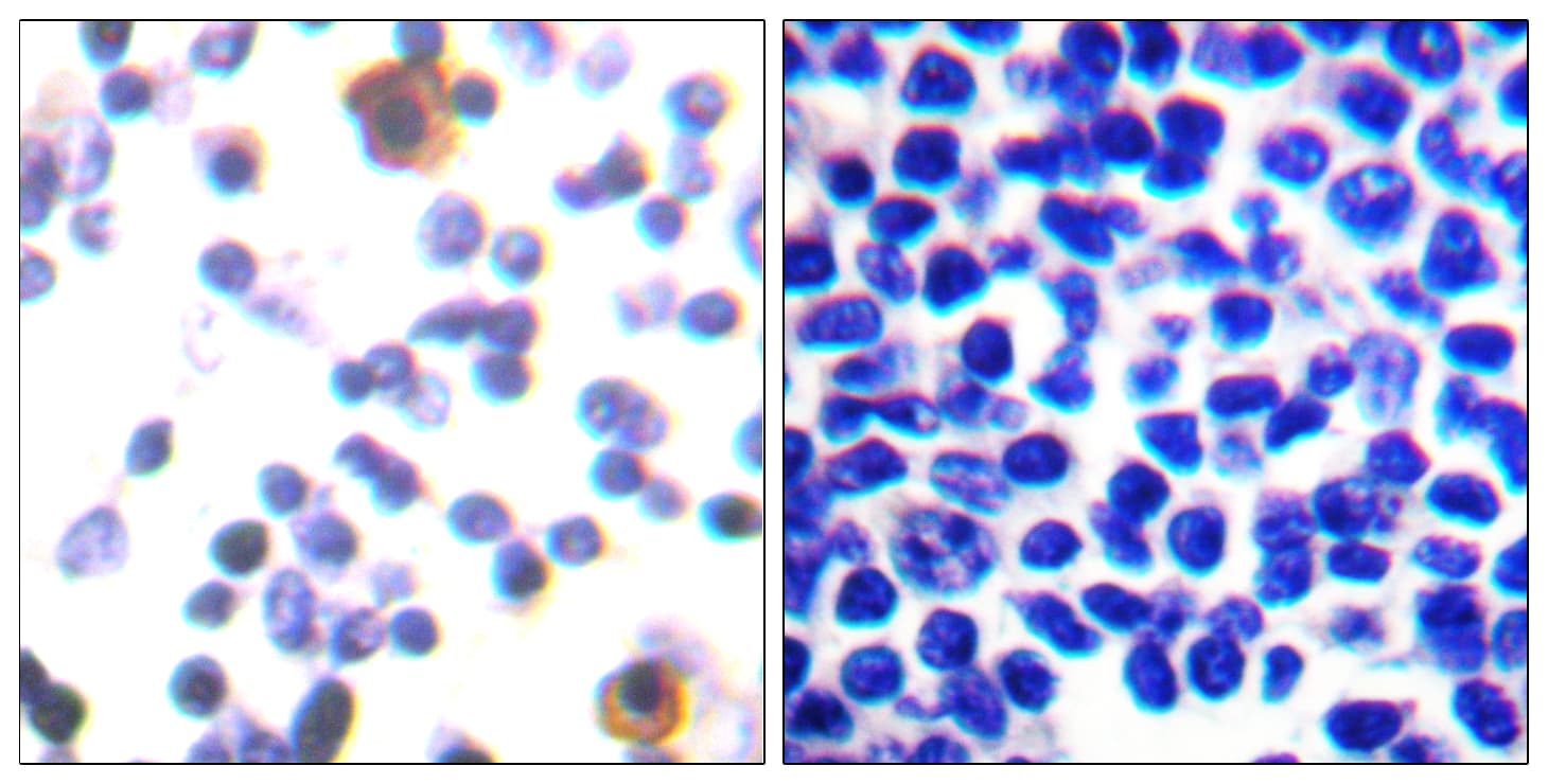 ZAP70 Antibody (phospho-Tyr315)