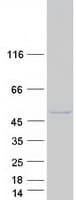 Human SSDP1 / SSBP3 Protein (Recombinant Myc-DDK (Flag))