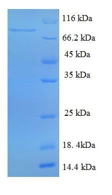 Human DENND1A Protein (Recombinant His-SUMO)