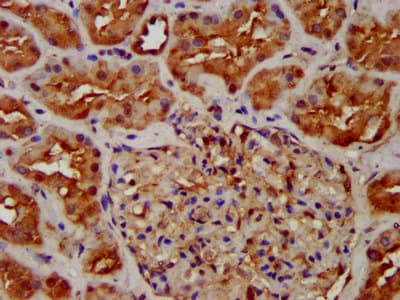 Polyclonal Rabbit anti-Human NUMBLIKE / NUMBL Antibody (IHC, IF)