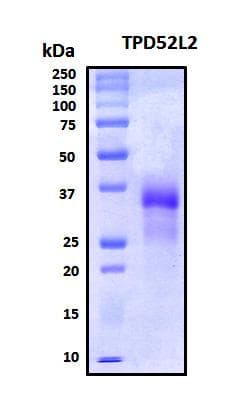 Human TPD52L2 / HD54 Protein (Recombinant His, N-Terminal)