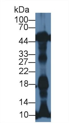NT-proANP Antibody (aa25-122, Biotin)