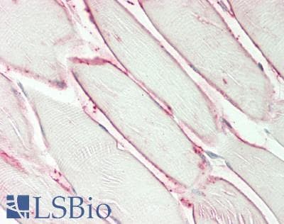 IHC-plus™ Polyclonal Rabbit anti-Human AQP4 / Aquaporin 4 Antibody (IHC, WB)