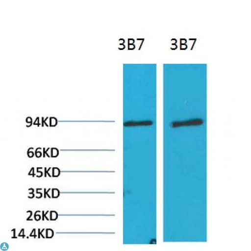 PIK3R1 / p85 Alpha Antibody
