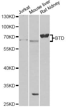 Polyclonal Rabbit anti-Human BTD / Biotinidase Antibody (WB)