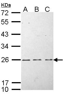 IHC-plus™ Polyclonal Rabbit anti-Human HRAS / H-Ras Antibody (aa111-189, IHC, WB)