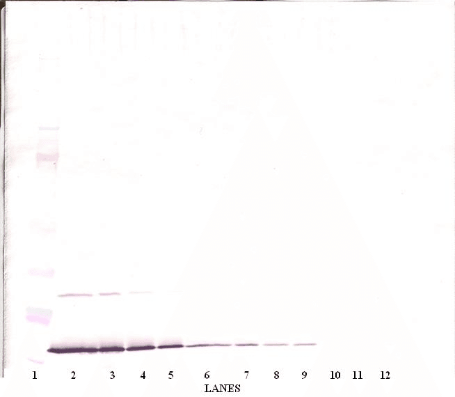IFN Gamma / Interferon Gamma Antibody (Biotin)
