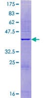 Human TOR1AIP2 Protein (Recombinant GST)