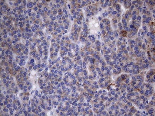 CRP / C-Reactive Protein Antibody (clone OTI1G10)