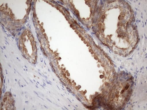 Monoclonal Mouse anti-Human EGLN2 / PHD1 Antibody (clone OTI7H3, IHC, WB)