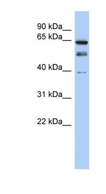 MYST2 / HBO1 Antibody (N-Terminus)