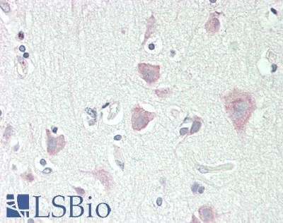 Polyclonal Rabbit anti-Human DLG2 / PSD93 Antibody (N-Terminus, IHC, WB)