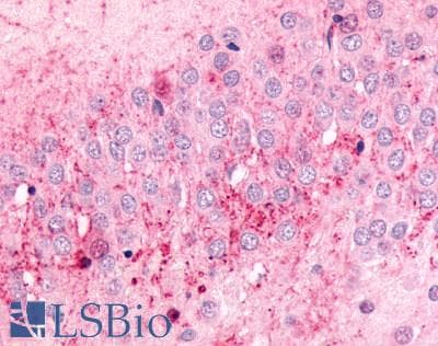PathPlus™ ADRA2C Antibody (Extracellular Domain)